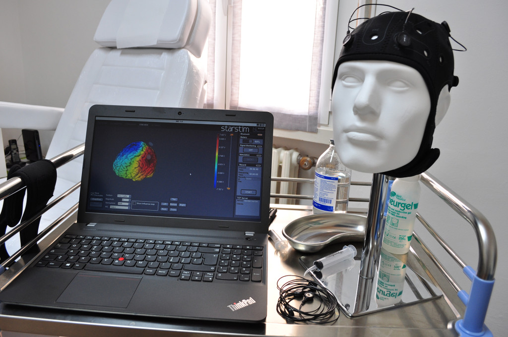tES per Parkinson e Alzheimer